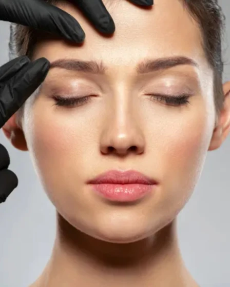 zgornja-blefaroplastika